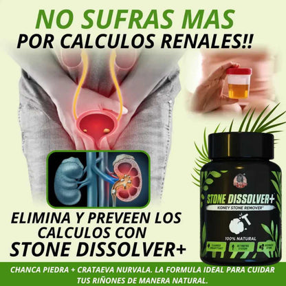 ¡Nuevo! Stone Dissolver™ La solución natural para los cálculos renales.