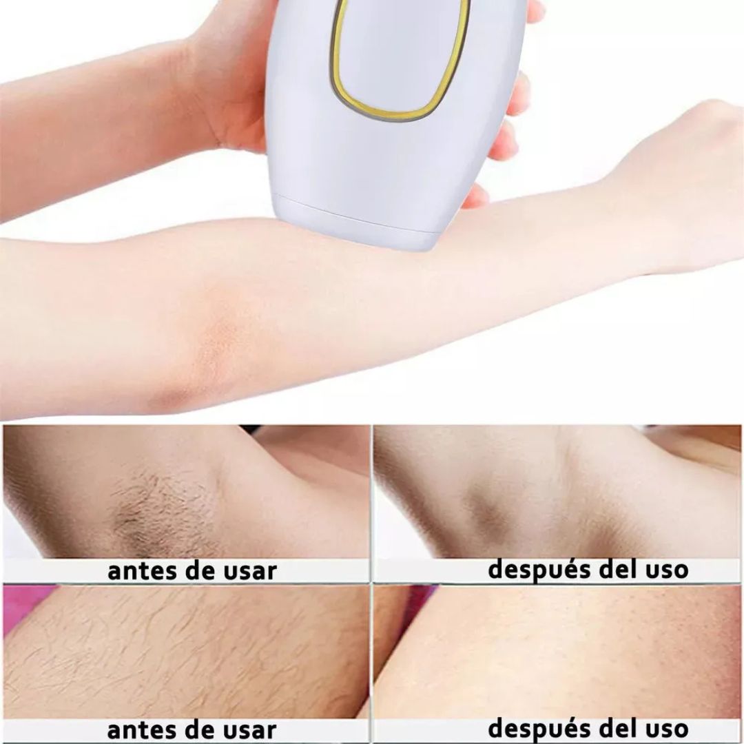 ✨ Despídete del vello para siempre, sin dolor y desde casa.